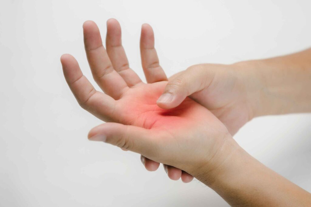 Rizartrosis por qué duele el pulgar y cómo recuperar su función
